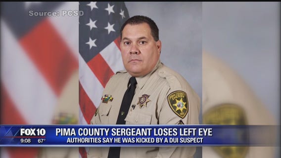 Tucson deputy loses eye following confrontation