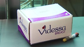 BREAST CANCER: Blood tests available that could catch the disease early