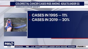 Colorectal cancer diagnosis rise in younger adults