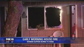 Woman suffers burns during early morning house fire in Sun City