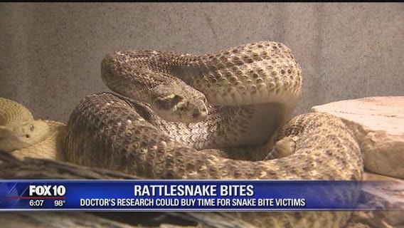 Arizona doctor's research could buy time for snake bite victims