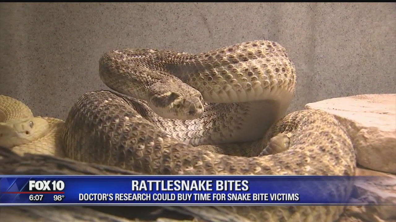 Arizona doctor's research could buy time for snake bite victims