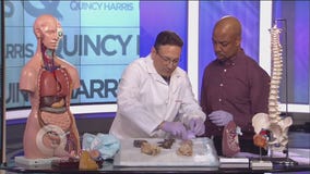 Dr. Mike Cirigliano shows smoker's lung vs healthy lung
