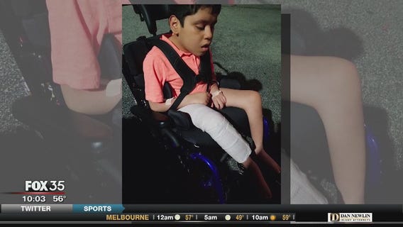 Mother of disabled boy says school's physical therapist broke his femur
