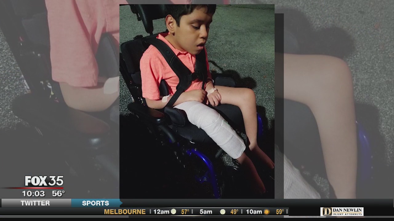 Mother of disabled boy says school's physical therapist broke his femur