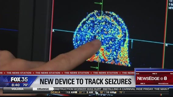 Seizure monitoring device could help people with epilepsy