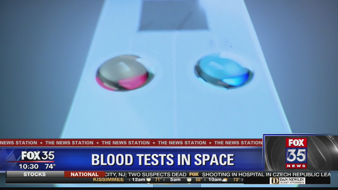 Device would allow for blood tests in space