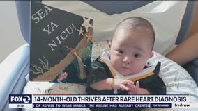 14-month-old baby thrives despite rare heart condition