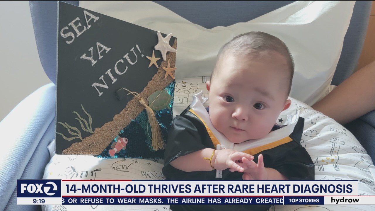 14-month-old baby thrives despite rare heart condition