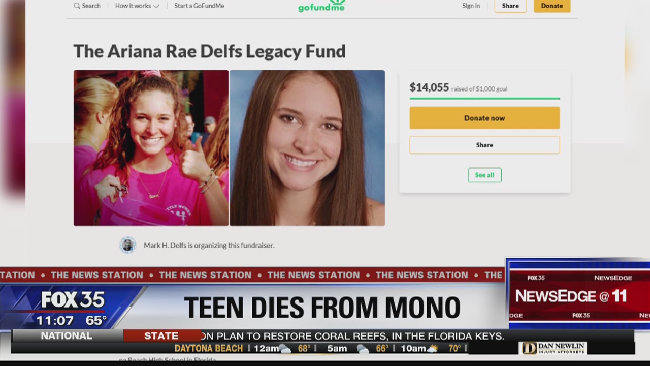 Florida teenager dies from mononucleosis