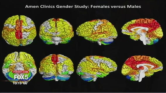 Brain study shows gender differences