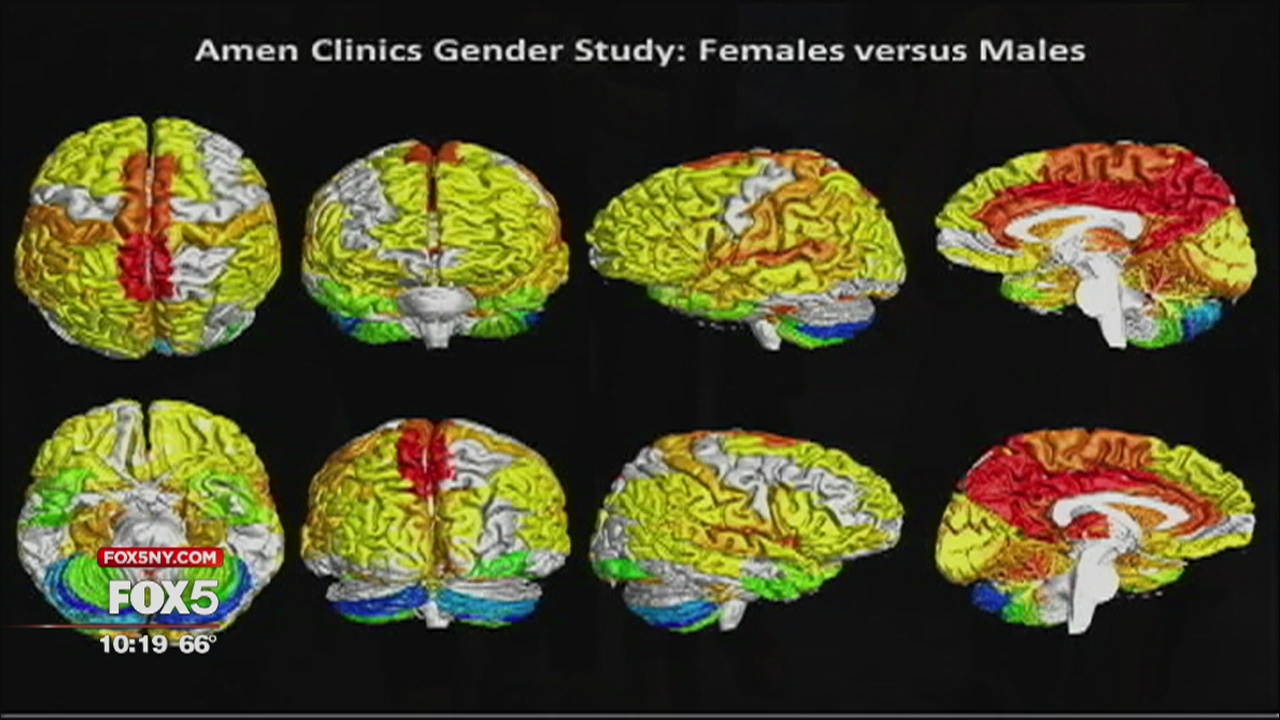 Brain study shows gender differences