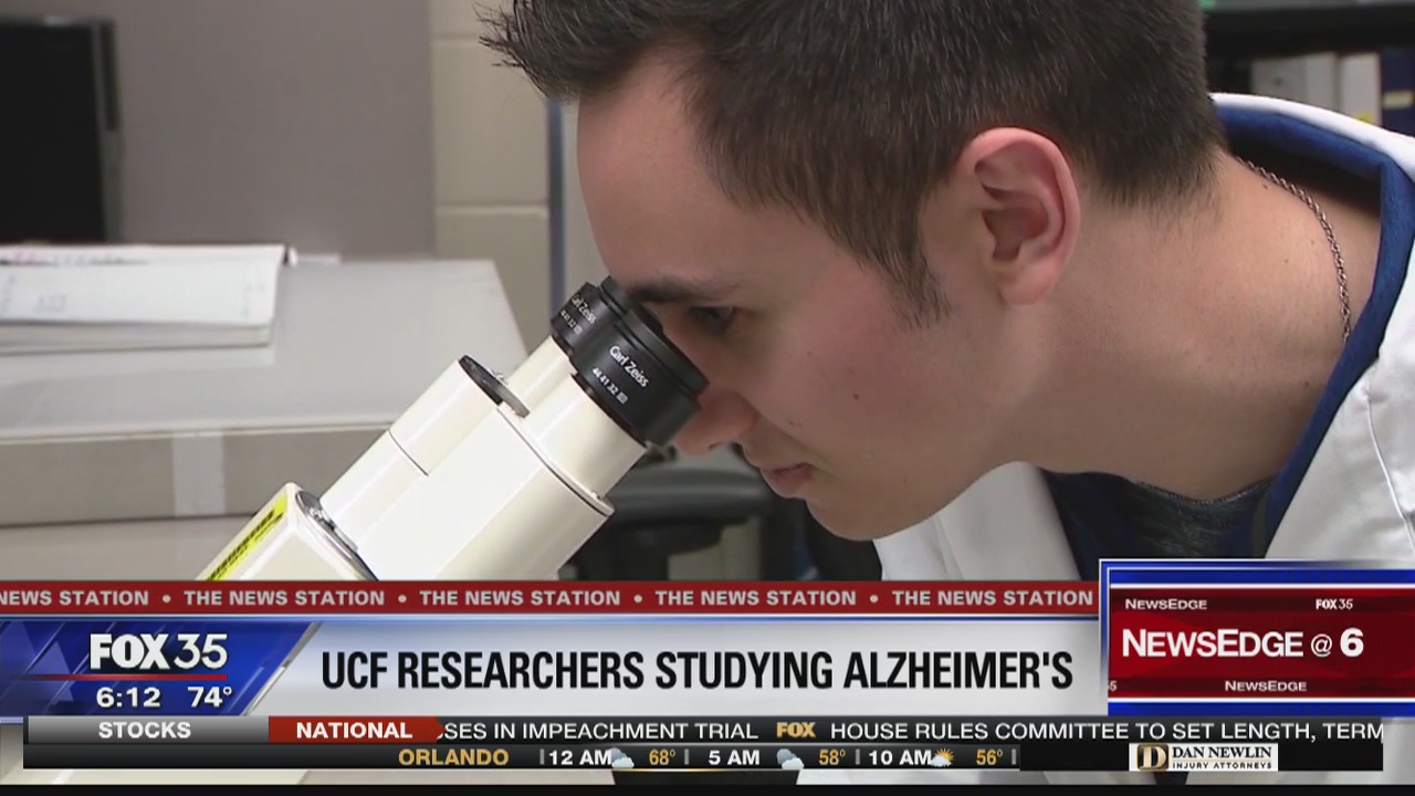UCF researchers studying Alzheimer's