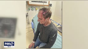 Man says woman in minivan ran into him on purpose in Emeryville