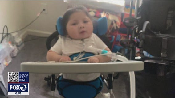 5-year-old disabled boy suffers life-threatening burns in Santa Rosa fire