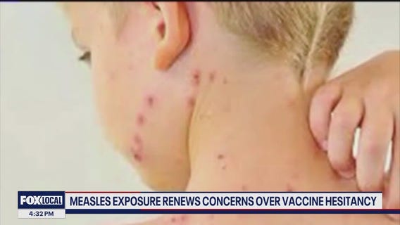 Measles exposure renews concerns over vaccine hesitancy
