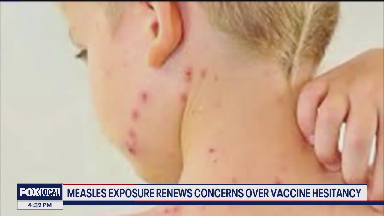 Measles exposure renews concerns over vaccine hesitancy