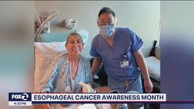 Minimally-invasive surgeries now available to treat esophageal cancer