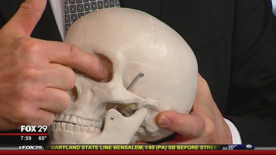 Dr. Mike talks about Joel Embiid injury