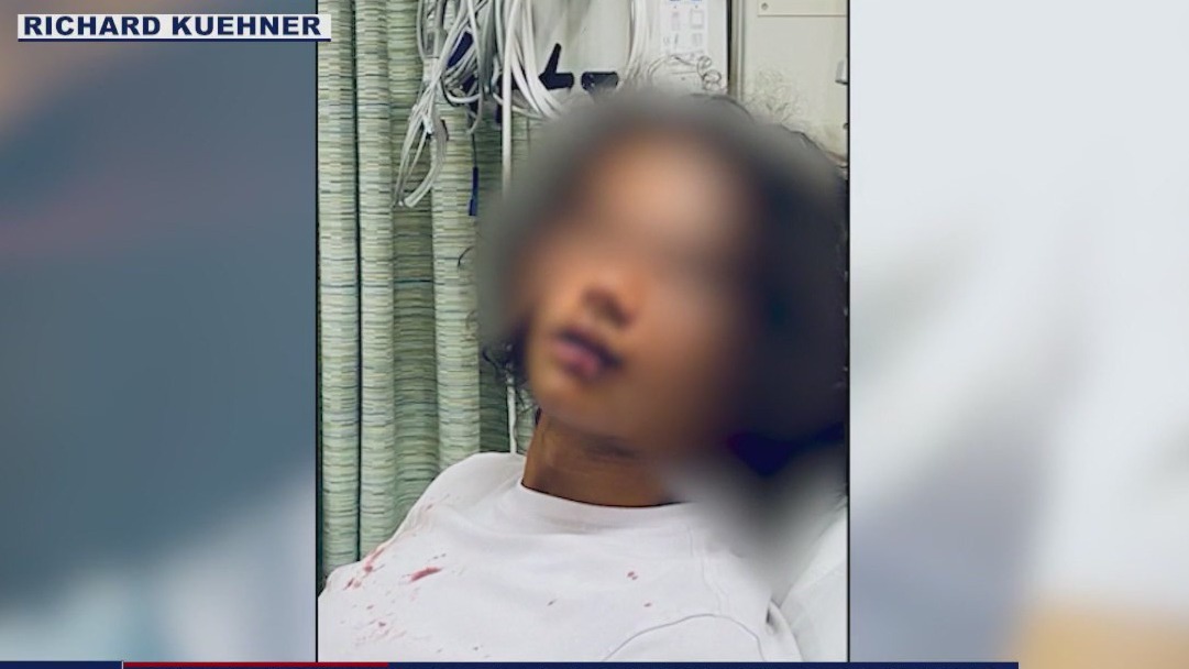 Father of teen beaten outside In-N-Out speaks