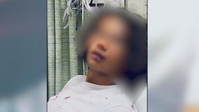 Several arrested in connection to teen's East Valley assault