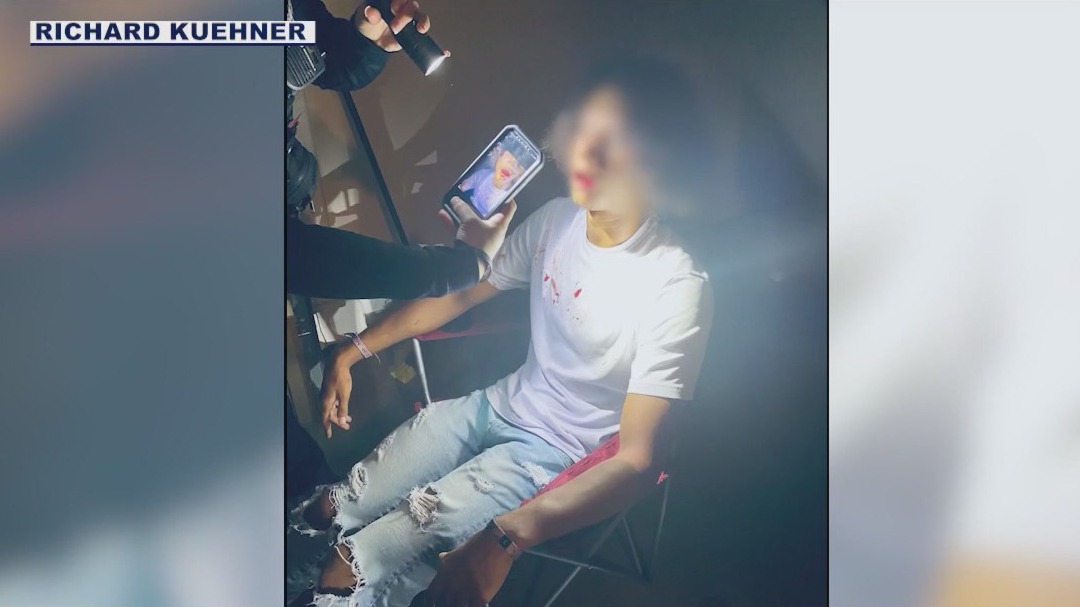 Father of teen attack victim talks about case