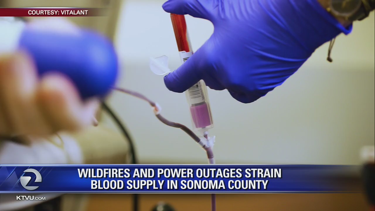 Wildfires and Power Outages Strain Blood Supply in Sonoma County
