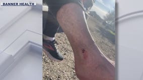 Retired nurse bitten by rattlesnake in Cave Creek