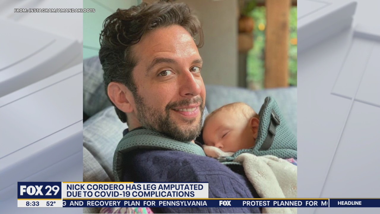 Coronavirus complications leads to amputation for Broadway performer