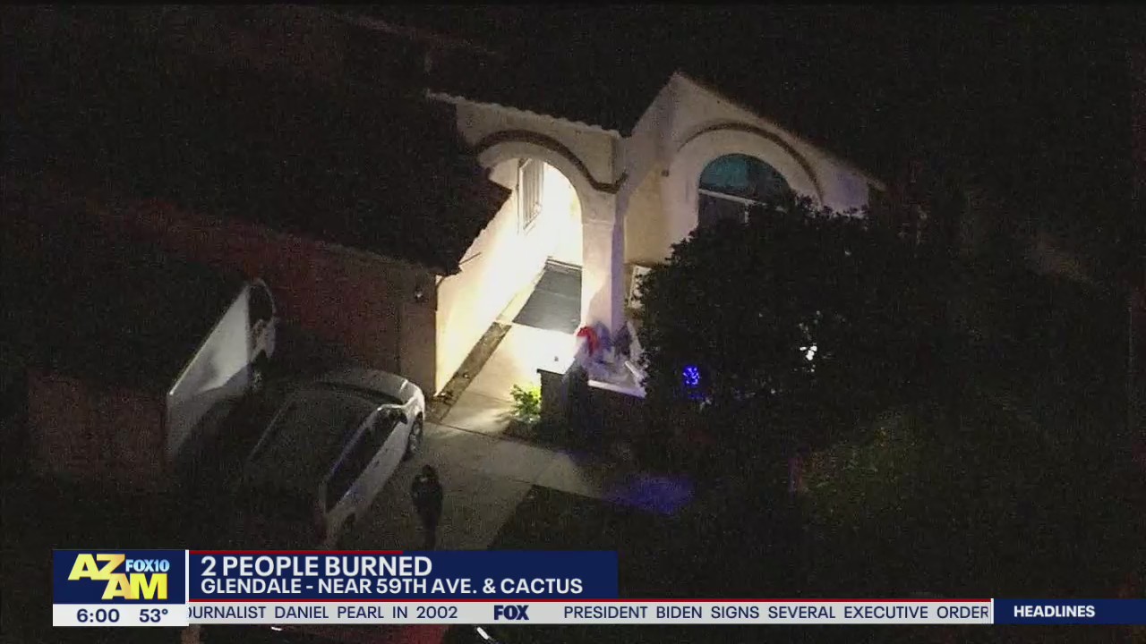 Man, child burned at Glendale home