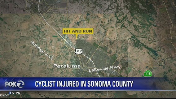 Cyclist injured in Sonoma County