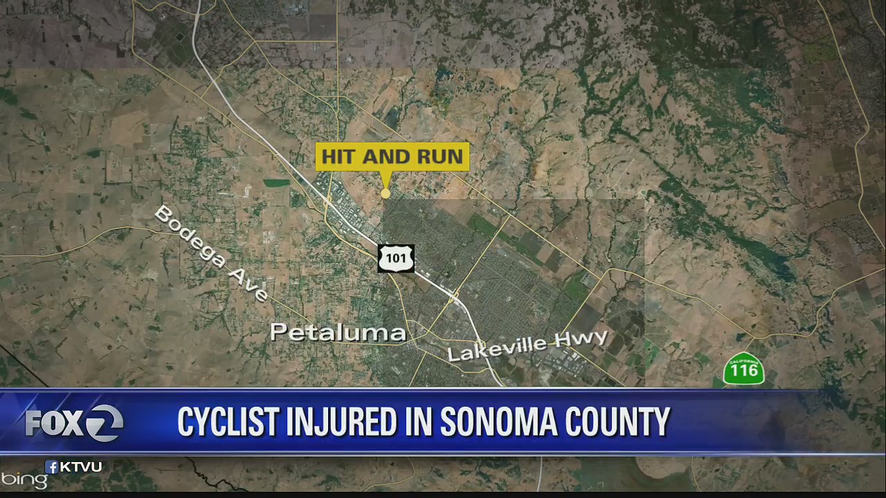 Cyclist injured in Sonoma County