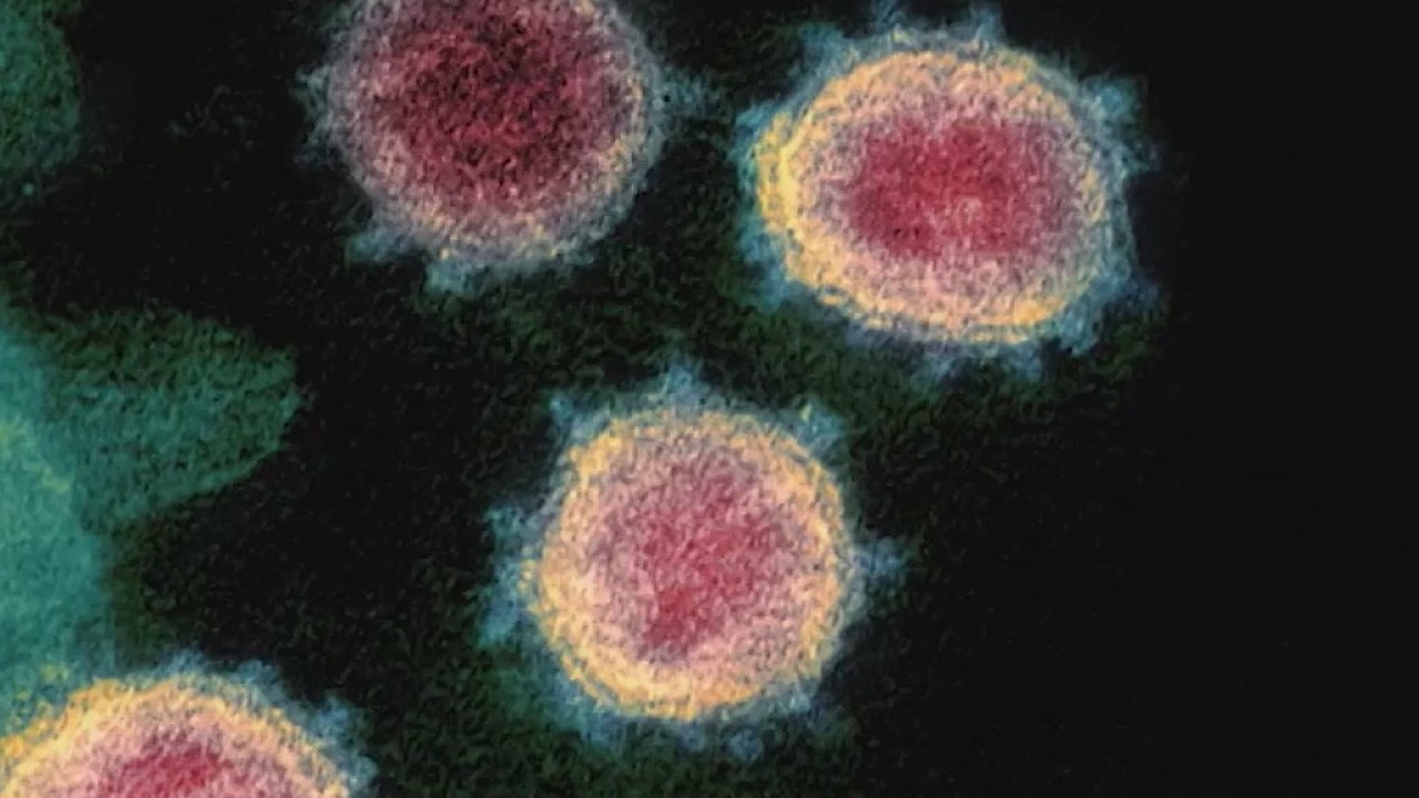 Coronavirus travel concerns