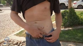 Tased, punched and kicked during traffic stop: Couple alleges excessive use of force