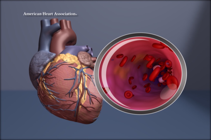 Healthier Together: Understanding heart disease, what to do in cardiac emergency