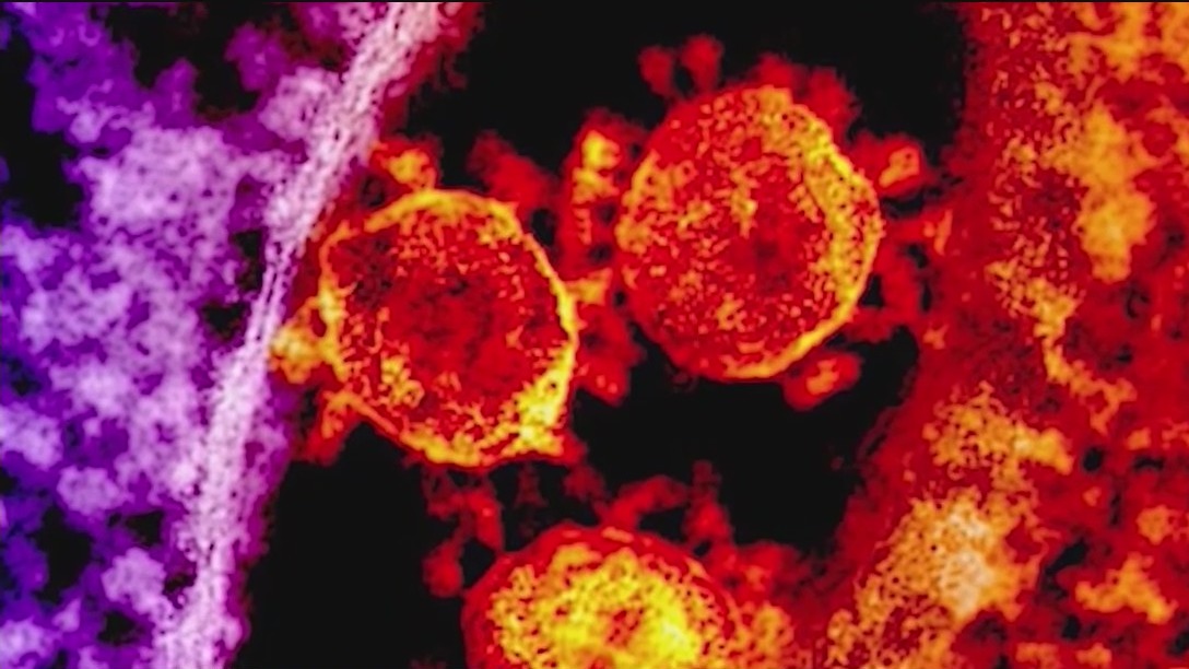 What is Flurona? More cases pop up of people catching flu and COVID-19 at the same time