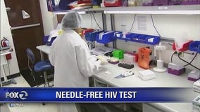 Stanford improves HIV 'spit' test