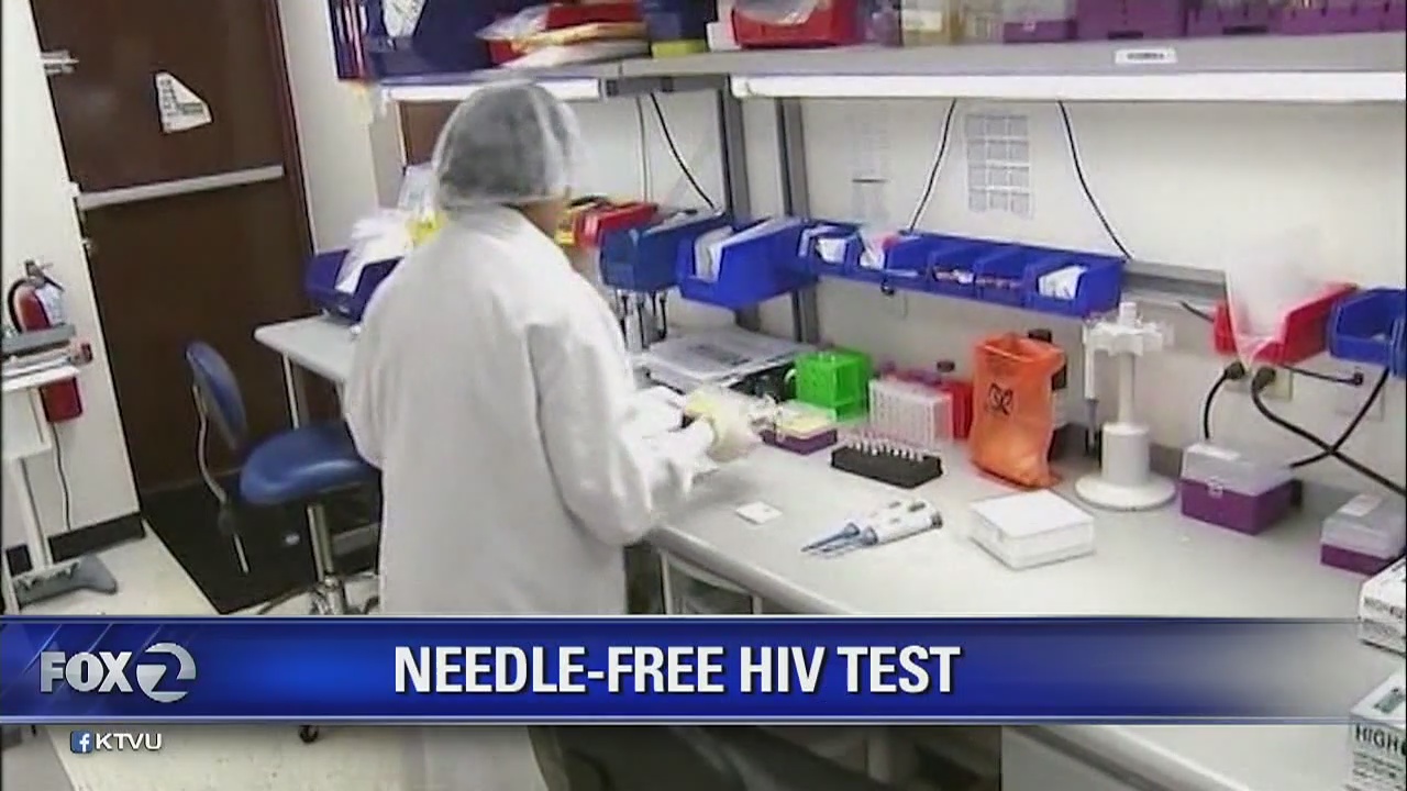 Stanford improves HIV 'spit' test