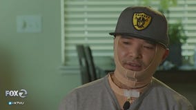 Burned contract worker sues Tesla after electrical explosion: 2 Investigates