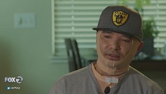 Burned contract worker sues Tesla after electrical explosion: 2 Investigates