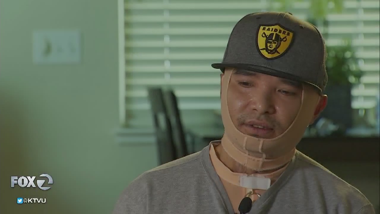 Burned contract worker sues Tesla after electrical explosion: 2 Investigates