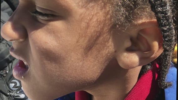 Substitute teacher allegedly slaps special needs student