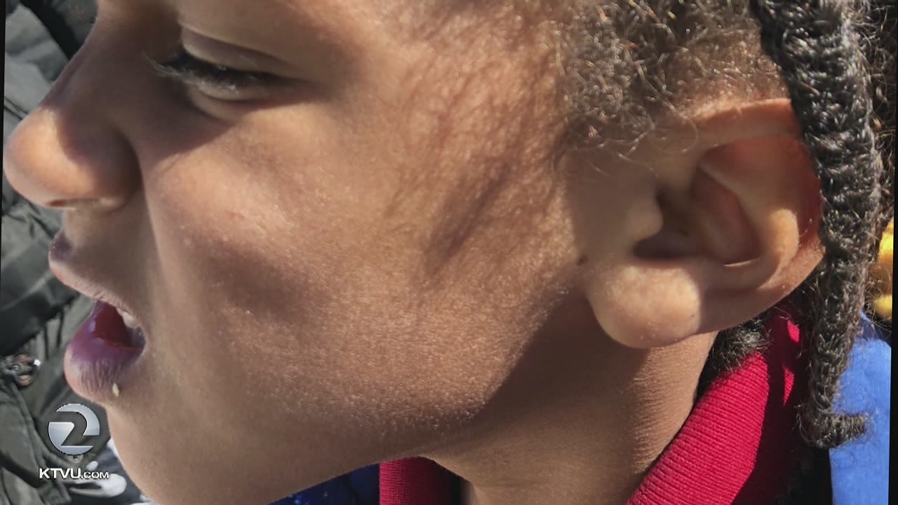 Substitute teacher allegedly slaps special needs student