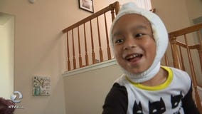 Teen saves brother from rottweiler mauling; stabs dog with scissors