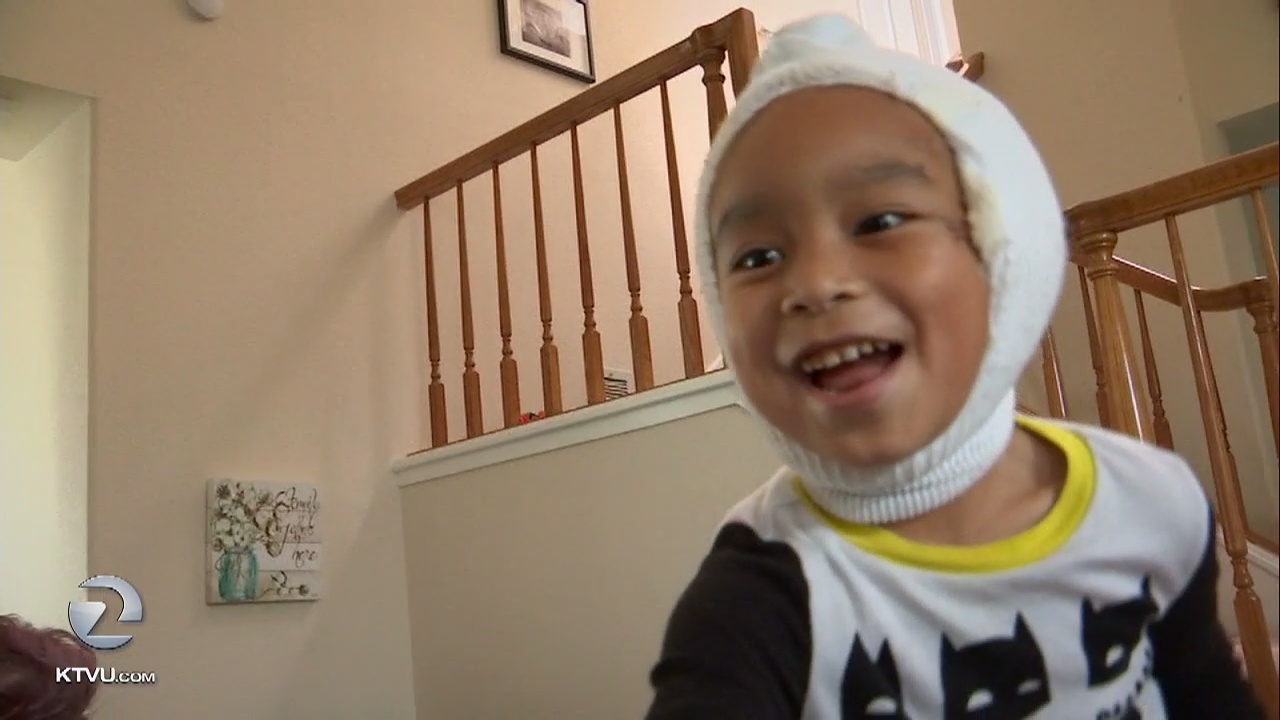 Teen saves brother from rottweiler mauling; stabs dog with scissors