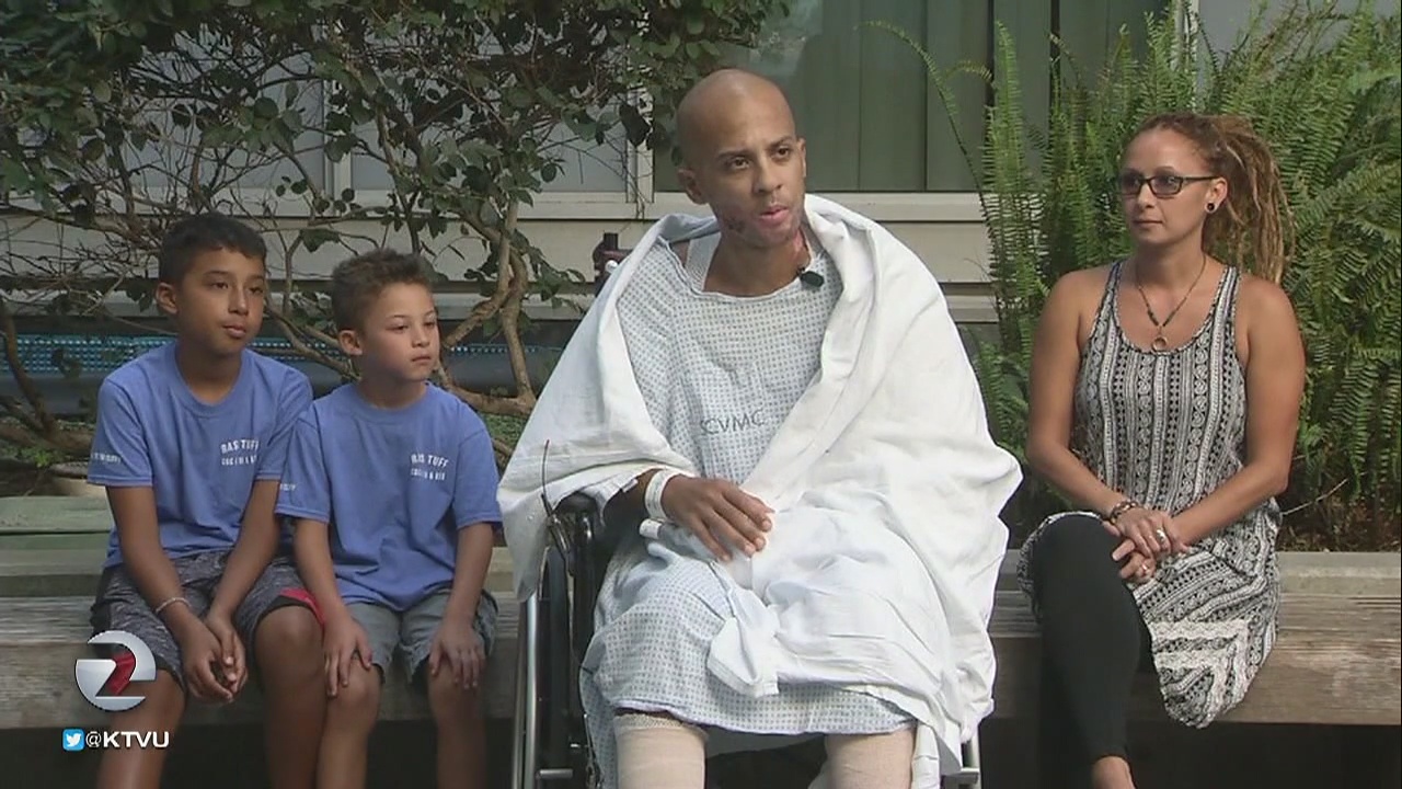 It's a miracle he's alive: San Jose man's road to recovery after bad electric burn