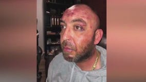 Fan beaten claims LAPD did nothing at scene