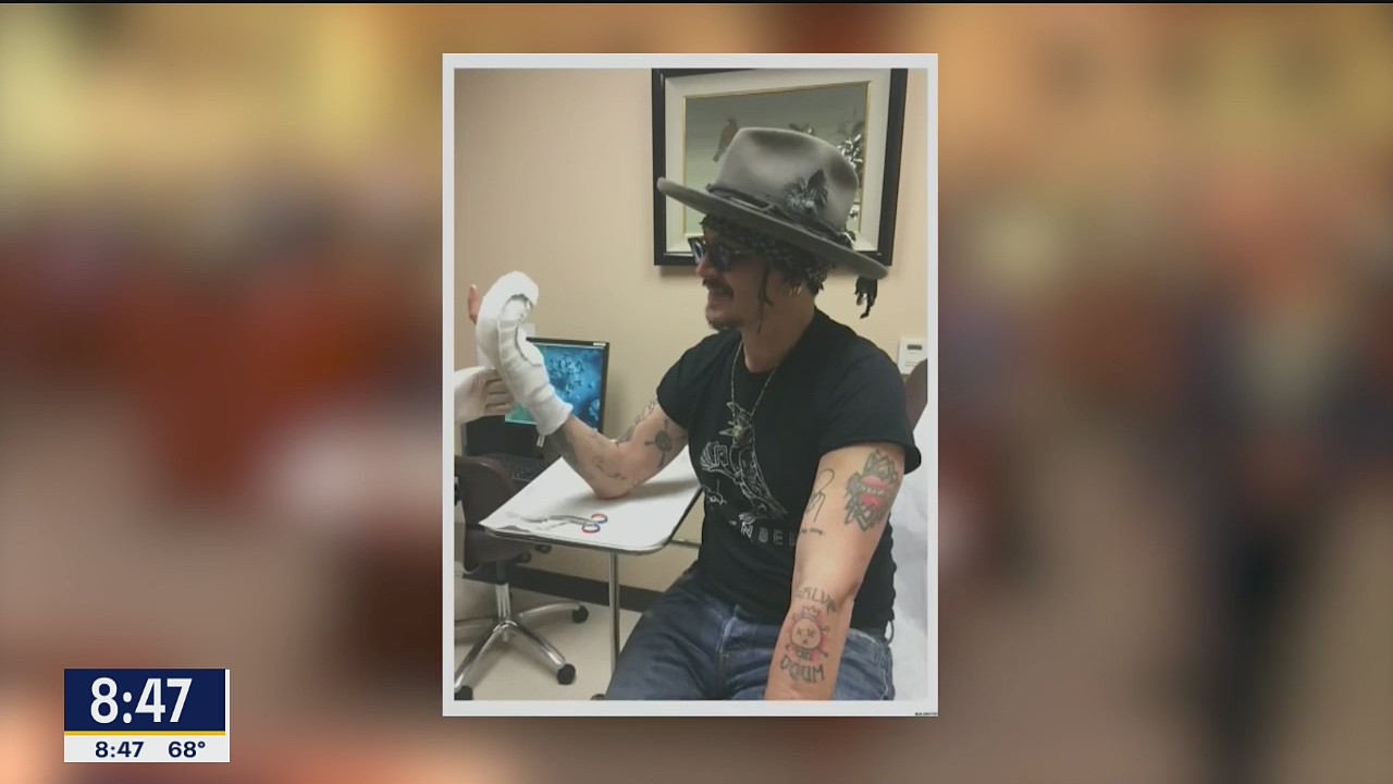 TMZ: Johnny Depp's severed finger