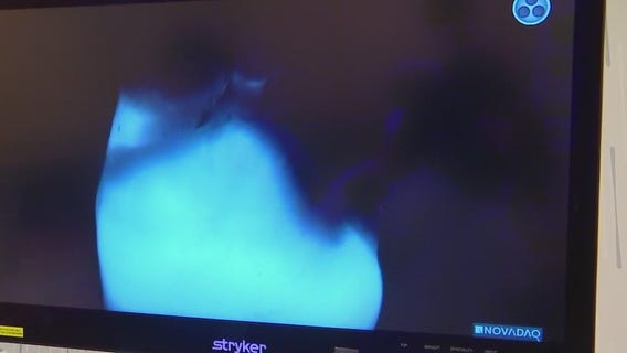 Frostbite danger explained by emergency physician