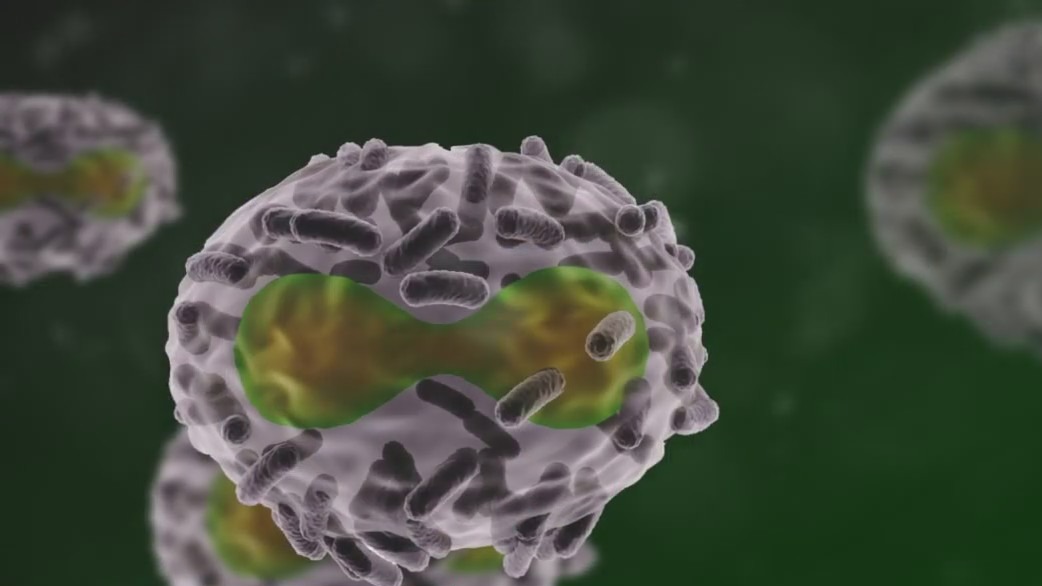 Chicago confirms deaths of two people with monkeypox